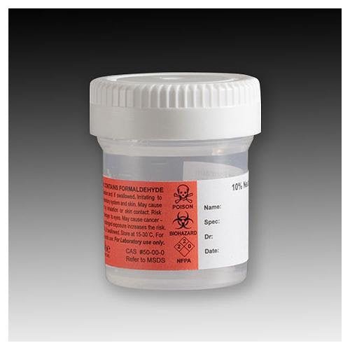 Prefilled 40mL formalin specimen containers with 10 percent NBF